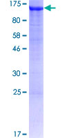 SDS-PAGE - Recombinant Human AP1B1 protein (GST tag N-Terminus) (AB157866)