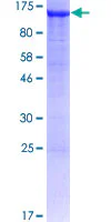 SDS-PAGE - Recombinant Human AP1B1 protein (GST tag N-Terminus) (AB157866)