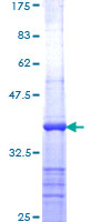 SDS-PAGE - Recombinant Human Apc1 protein (AB163855), expandable thumbnail