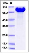 SDS-PAGE - Recombinant Human APLP1 protein (His tag) (AB276580), expandable thumbnail