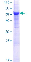 SDS-PAGE - Recombinant Human APMAP protein (AB132786)
