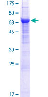 SDS-PAGE - Recombinant Human APMAP protein (AB132786)