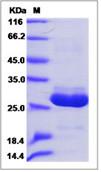 SDS-PAGE - Recombinant Human APOA1BP protein (His tag) (AB276539)