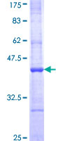 Recombinant Human APOBEC1 protein