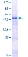 SDS-PAGE - Recombinant Human APOBEC3B protein (GST tag N-Terminus) (AB160558)