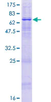 SDS-PAGE - Recombinant Human APOBEC3D protein (AB165460)