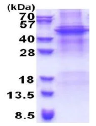 SDS-PAGE - Recombinant Human APOBEC4 protein (denatured) (His tag N-Terminus) (AB171472)