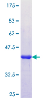 SDS-PAGE - Recombinant Human APOL6 protein (AB164299)