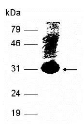 SDS-PAGE - Recombinant Human Apolipoprotein B (AB80037)