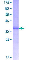 SDS-PAGE - Recombinant Human Apolipoprotein CIII (AB157899)