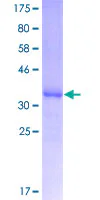 SDS-PAGE - Recombinant Human Apolipoprotein CIII (GST tag N-Terminus) (AB157899)