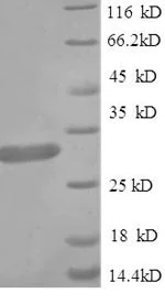 SDS-PAGE - Recombinant Human Apolipoprotein CIII (Tagged) (AB235684)