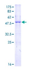Recombinant Human Apolipoprotein L1/APOL1