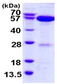 SDS-PAGE - Recombinant Human APPBP1 protein (His tag N-Terminus) (AB116199)