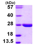 SDS-PAGE - Recombinant Human APT-2 protein (His tag N-Terminus) (AB105129)