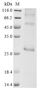 SDS-PAGE - Recombinant Human AQP5 Protein (His Tag) (AB314611)