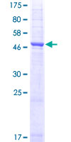 SDS-PAGE - Recombinant Human Aquaporin 1 protein (AB114210), expandable thumbnail