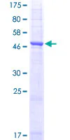 SDS-PAGE - Recombinant Human Aquaporin 1 protein (GST tag N-Terminus) (AB114210)