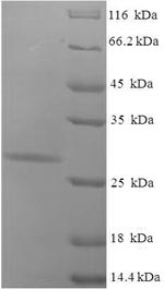 SDS-PAGE - Recombinant Human Aquaporin 1 protein (Tagged) (AB225647), expandable thumbnail