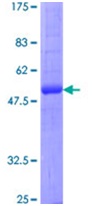 Recombinant Human Aquaporin 2 protein