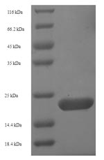 SDS-PAGE - Recombinant Human Aquaporin 4 protein (Tagged) (AB225651)