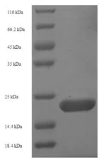 SDS-PAGE - Recombinant Human Aquaporin 4 protein (Tagged) (AB225651)