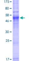 SDS-PAGE - Recombinant Human Aquaporin 7 protein (AB157901)