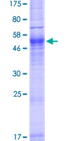 SDS-PAGE - Recombinant Human Aquaporin 7 protein (GST tag N-Terminus) (AB157901)