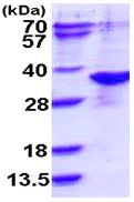 SDS-PAGE - Recombinant Human ARD1A protein (AB113135)