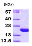 SDS-PAGE - Recombinant Human ARF6 protein (AB102025)
