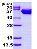 SDS-PAGE - Recombinant Human Argininosuccinate Lyase protein (His tag N-Terminus) (AB113605)