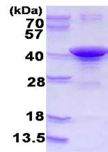 SDS-PAGE - Recombinant Human ARH protein (His tag N-Terminus) (AB123174)