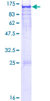 Recombinant Human ARHGAP17 protein