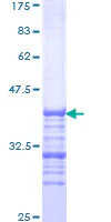 SDS-PAGE - Recombinant Human ARID1B protein (GST tag N-Terminus) (AB163568)