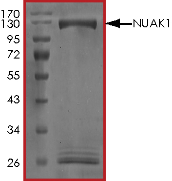 Recombinant human ARK5 protein