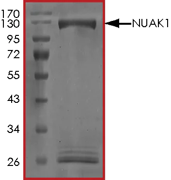 SDS-PAGE - Recombinant human ARK5 protein (AB125626)