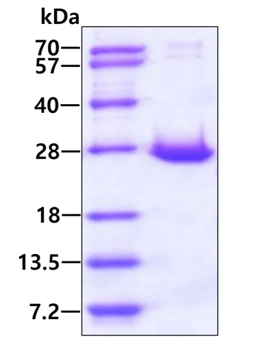 SDS-PAGE - Recombinant Human ARL14 protein (AB113588)