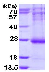 SDS-PAGE - Recombinant Human ARL14 protein (AB113588)