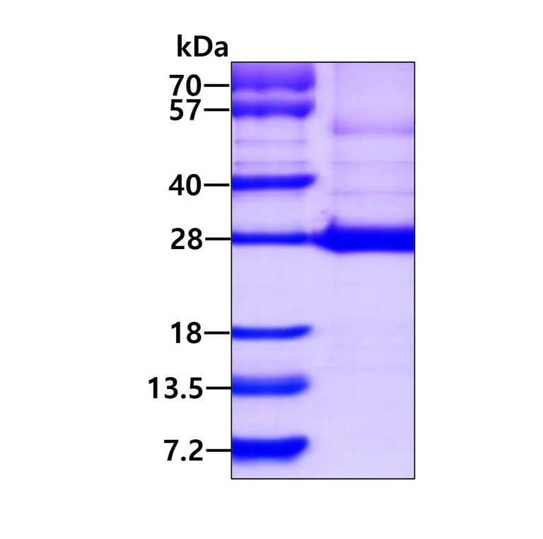 SDS-PAGE - Recombinant Human ARL15 protein (His tag N-Terminus) (AB113118)