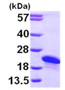 SDS-PAGE - Recombinant Human ARL2BP protein (AB101067)