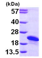 SDS-PAGE - Recombinant Human ARL2BP protein (His tag N-Terminus) (AB101067)