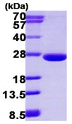 SDS-PAGE - Recombinant Human ARL3 protein (AB113590)