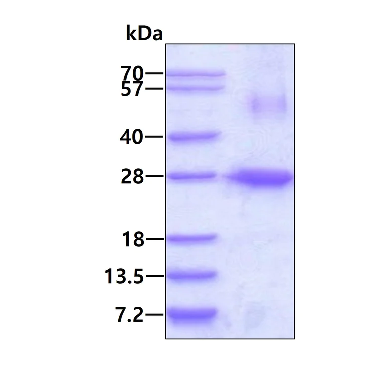 SDS-PAGE - Recombinant Human ARL4A protein (AB109841)