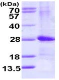 SDS-PAGE - Recombinant Human ARL4D protein (AB113130)