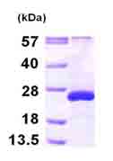 SDS-PAGE - Recombinant Human ARL5A protein (AB101943), expandable thumbnail