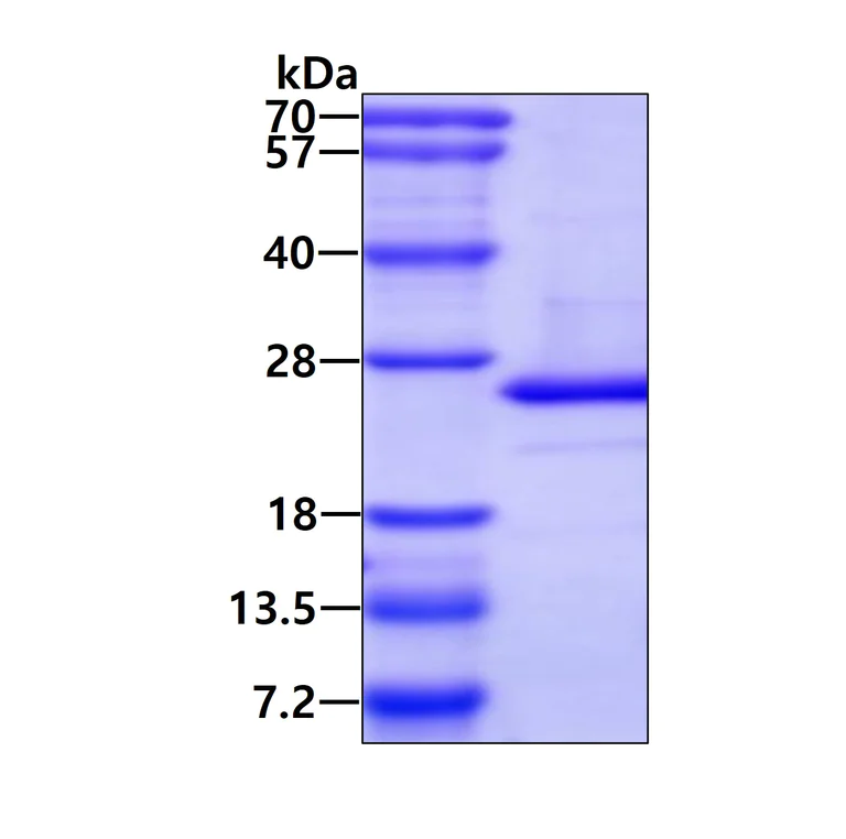 SDS-PAGE - Recombinant Human ARL5A protein (His tag N-Terminus) (AB101943)
