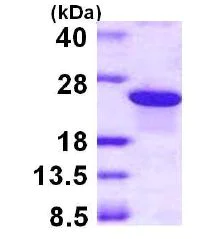 SDS-PAGE - Recombinant Human ARL5B protein (AB113159)