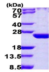 SDS-PAGE - Recombinant Human ARL6 protein (His tag N-Terminus) (AB108125)