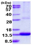 SDS-PAGE - Recombinant Human ARL9 protein (AB123161), expandable thumbnail