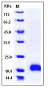 SDS-PAGE - Recombinant Human ARMET/ARP protein (His tag) (AB276381)